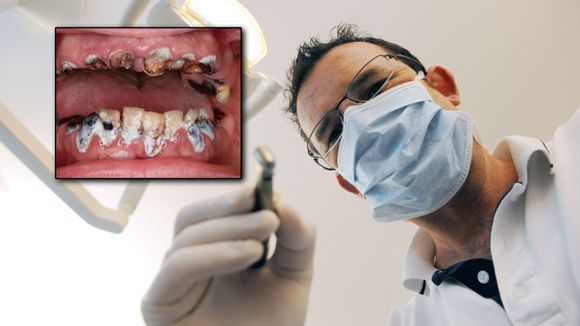Parkinson og tannbehandling